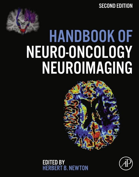 Handbook of Neuro-Oncology Neuroimaging - 