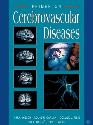 Primer on Cerebrovascular Diseases - 