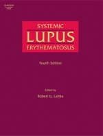 Systemic Lupus Erythematosus - 