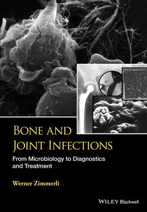 Bone and Joint Infections - W. Zimmerli