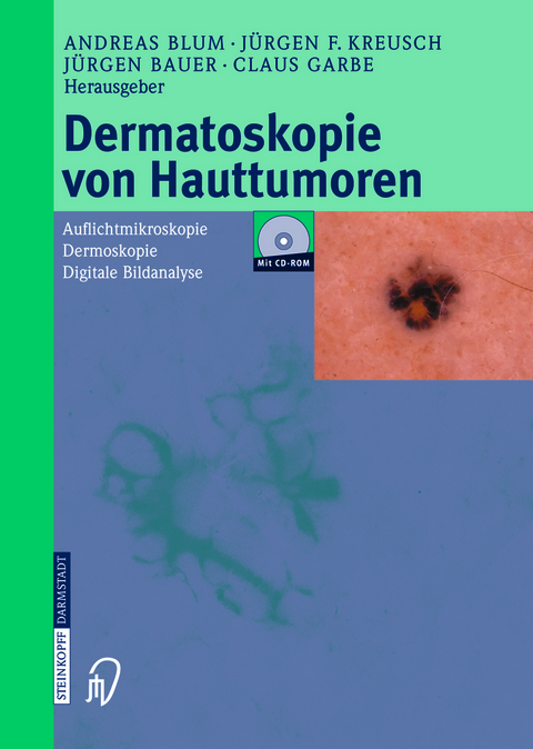 Dermatoskopie von Hauttumoren - 