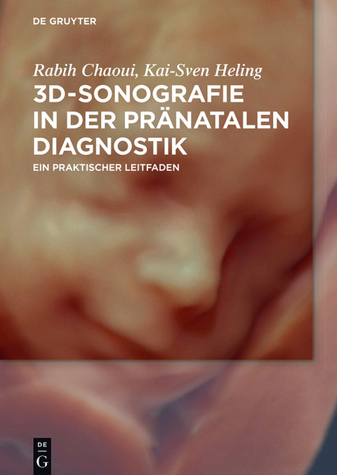 3D-Sonografie in der pränatalen Diagnostik - Rabih Chaoui, Kai-Sven Heling