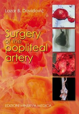 Surgery of the Popliteal Artery - Lazar B. Davidovic