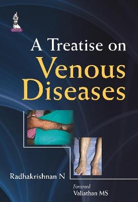 A Treatise on Venous Diseases - N Radhakrishnan