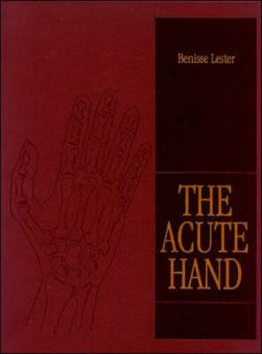 ACUTE HAND -  Lester