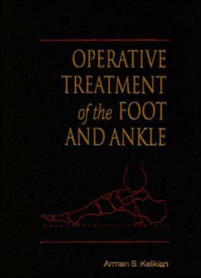 Operative Treatment of the Foot and Ankle - Armen Kelkikian