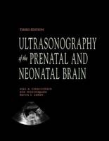 Ultrasonography of the Prenatal &  Neonatal Brain - Ilan Timor-Tritsch, Ana Monteagudo, Harris Cohen