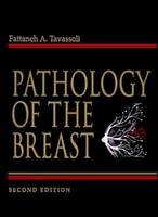 Pathology of The Breast - Fattaneh Tavassoli