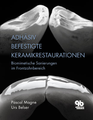 Adhäsiv befestigte Keramikrestaurationen - Pascal Magne, Urs Belser