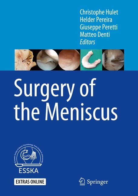 Surgery of the Meniscus - 