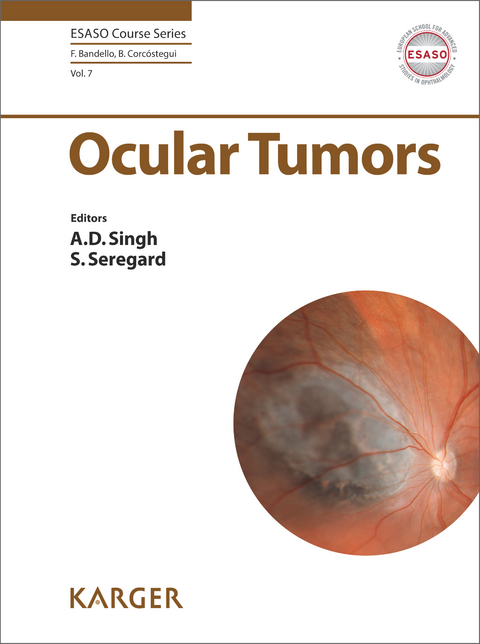 Ocular Tumors - 