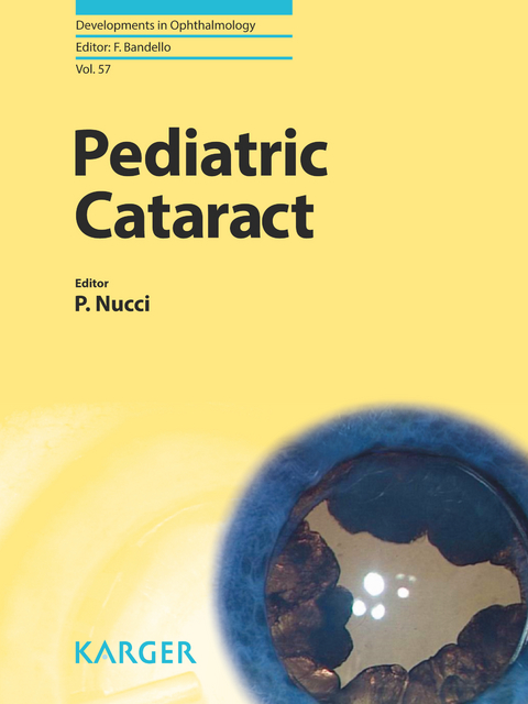 Pediatric Cataract - 