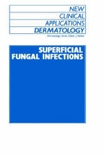 Superficial Fungal Infections - 