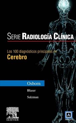 Serie Radiología Clínica: Los 100 Diagnósticos Principales En Cerebro - Anne G Osborn