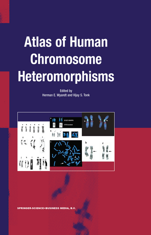 Atlas of Human Chromosome Heteromorphisms - 