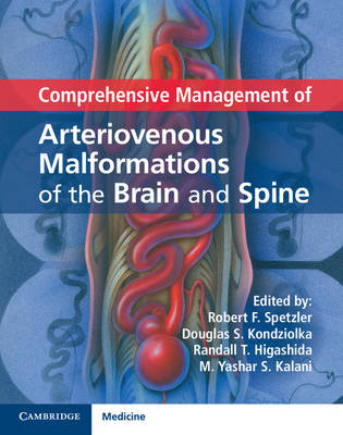 Comprehensive Management of Arteriovenous Malformations of the Brain and Spine - 