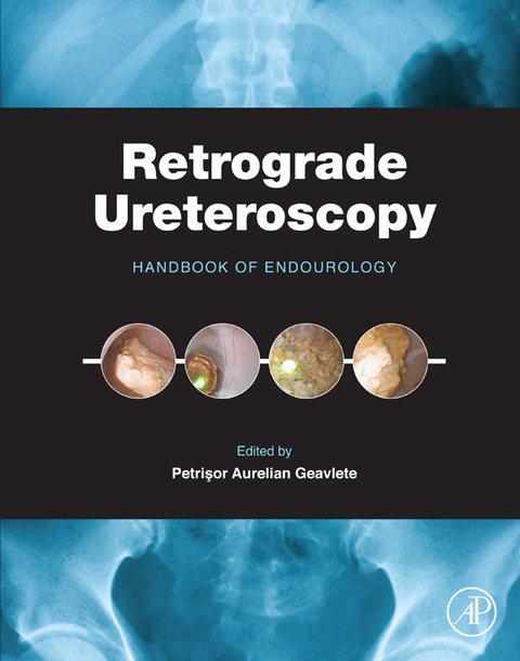 Retrograde Ureteroscopy - 