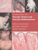 Color Atlas of Vascular Tumors and Vascular Malformations - Odile Enjolras, Michel Wassef, Rene Chapot