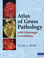 Atlas of Gross Pathology - Alan G. Rose