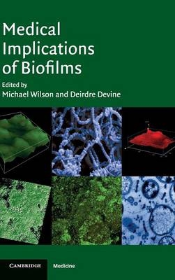 Medical Implications of Biofilms - 