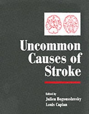 Stroke Syndromes (Second Edition) and Uncommon Causes of Stroke 2 Volume Hardback Set - 