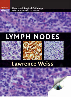 Lymph Nodes - Lawrence M. Weiss