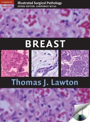 Breast - Thomas J. Lawton