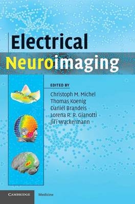 Electrical Neuroimaging - 