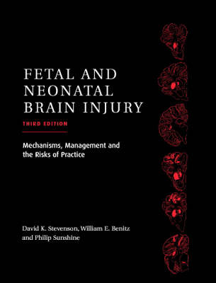 Fetal and Neonatal Brain Injury - 