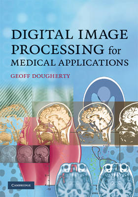 Digital Image Processing for Medical Applications - Geoff Dougherty