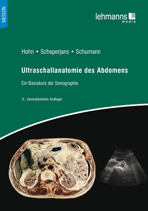 Ultraschall des Abdomens - 