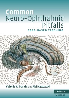 Common Neuro-Ophthalmic Pitfalls - Valerie A. Purvin, Aki Kawasaki