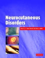 Neurocutaneous Disorders - 