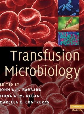 Transfusion Microbiology - 