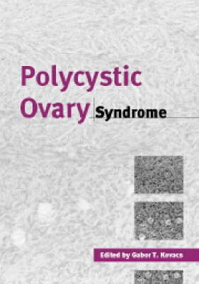 Polycystic Ovary Syndrome - 