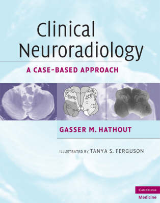 Clinical Neuroradiology - Gasser M. Hathout