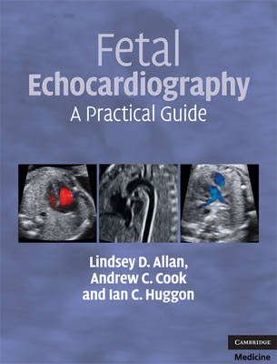 Fetal Echocardiography - Lindsey D. Allan, Andrew C. Cook, Ian C. Huggon