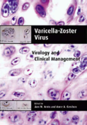 Varicella-Zoster Virus - 