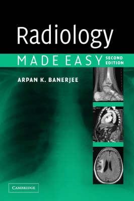 Radiology Made Easy - Arpan K. Banerjee