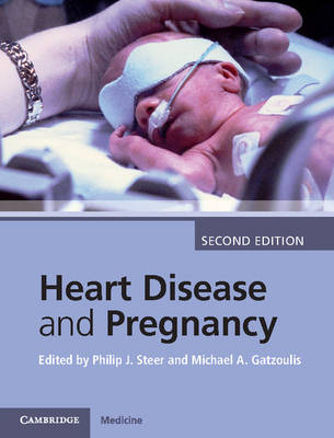 Heart Disease and Pregnancy - 