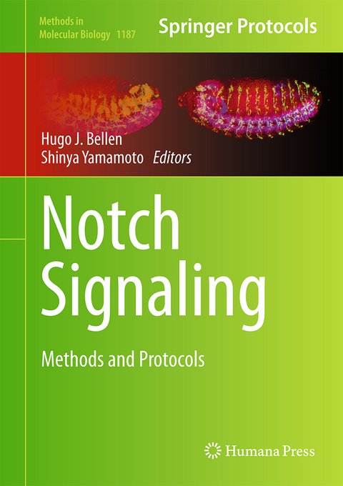 Notch Signaling - 