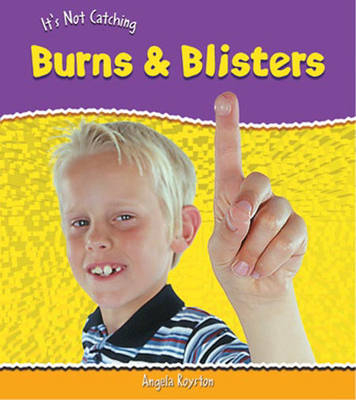 It's Not Catching: Burns And Blisters Paperback