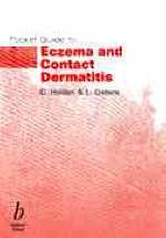 Pocket Guide to Eczema and Contact Dermatitis - Colin Holden, Lucy Ostlere