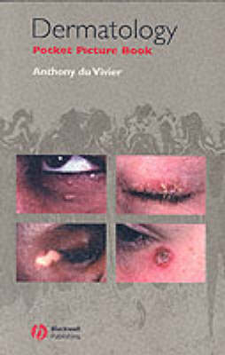 Dermatology Pocket Picture Book - Dr Anthony DuVivier