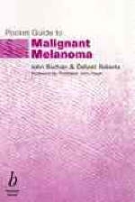 Pocket Guide to Malignant Melanoma -  BUCHAN