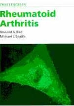 Questions and Uncertainties in Rheumatoid Arthritis - Howard A. Bird, Michael Snaith