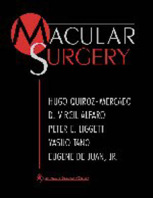 Macular Surgery - 