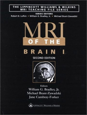 MRI of the Brain - 