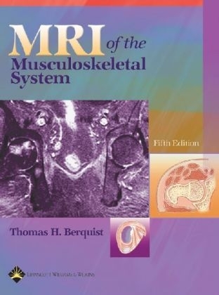 MRI of the Musculoskeletal System - 