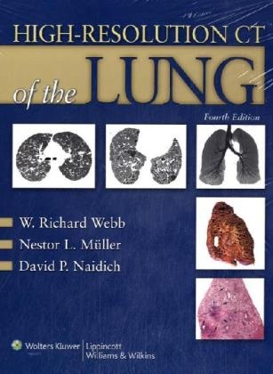 High-resolution CT of the Lung - W.Richard Webb, Nestor Luiz Muller, David P. Naidich